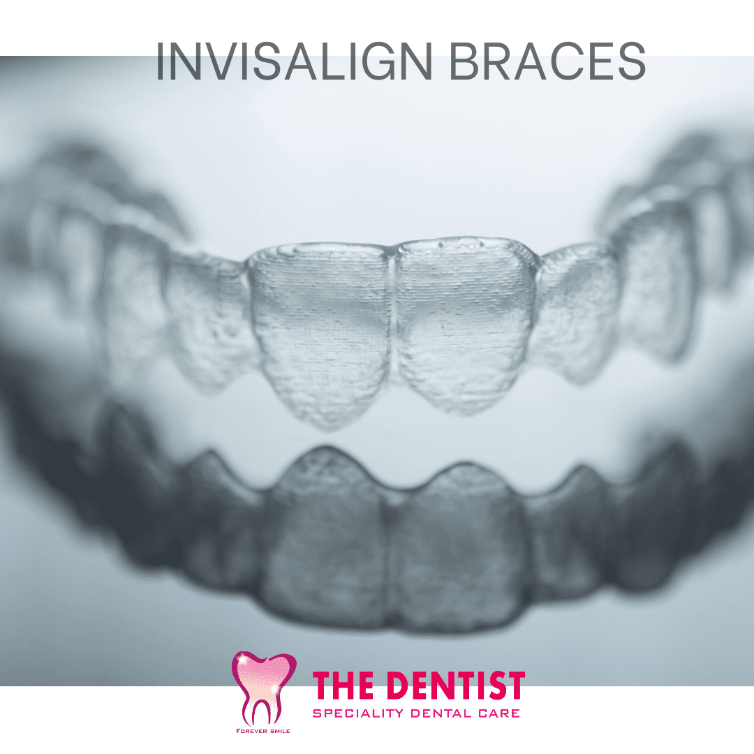 How much will my Invisalign clear aligners cost in Kerala?