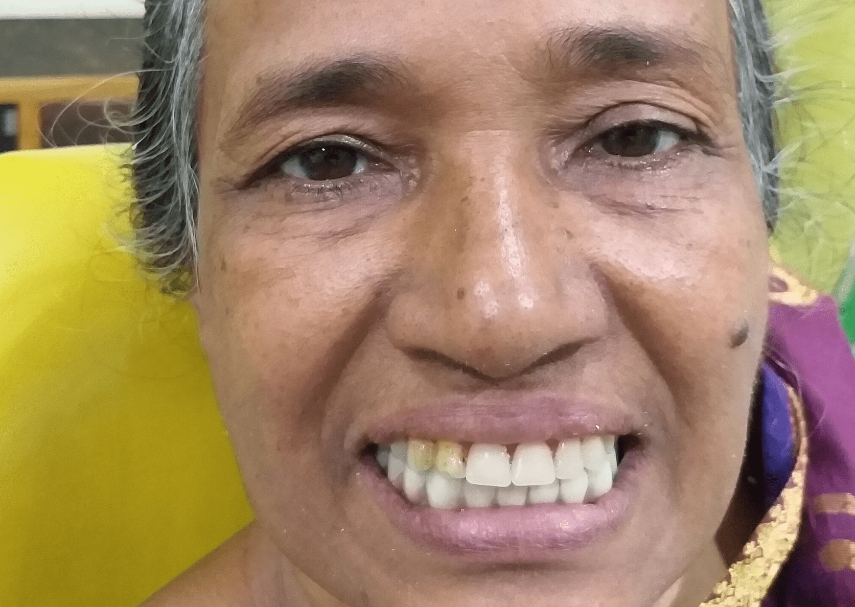 Smile Gallery